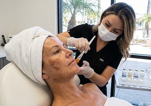 Can Chemical Peels Help Lighten Dark Spots in Costa Mesa?