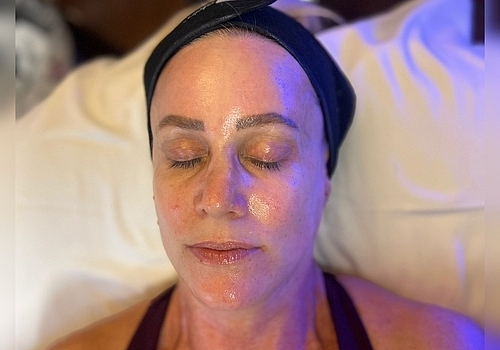 What to Expect During Your First Chemical Peel in Costa Mesa